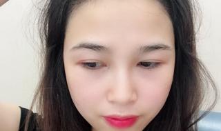 植发多少钱一次 植发多少钱一次